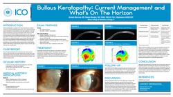 Bullous Keratopathy- Current Management and What’s On The Horizon
